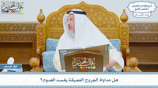2253 - هل مداواة الجروح العميقة يفسد الصوم؟ - عثمان الخميس