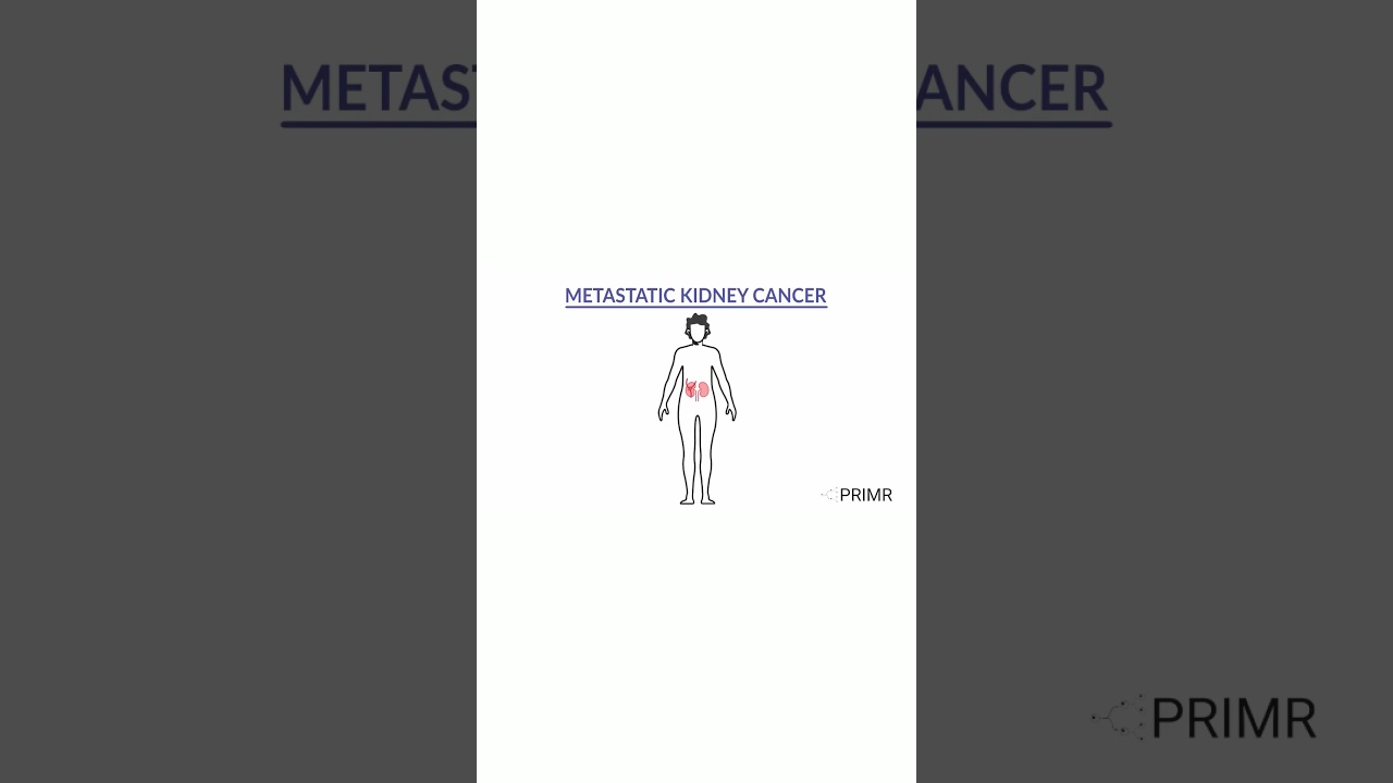 What can be done for #kidneycancer that has spread to bones?
