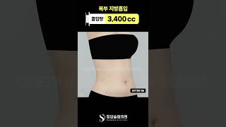힘 줘도 튀어나오던 배, 지금은 없음 #뱃살제거
