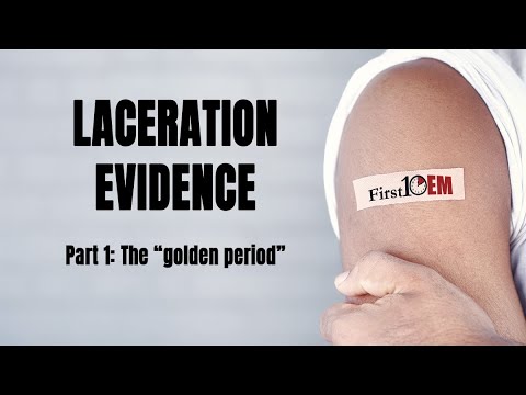 Is there a time limit on laceration repair?