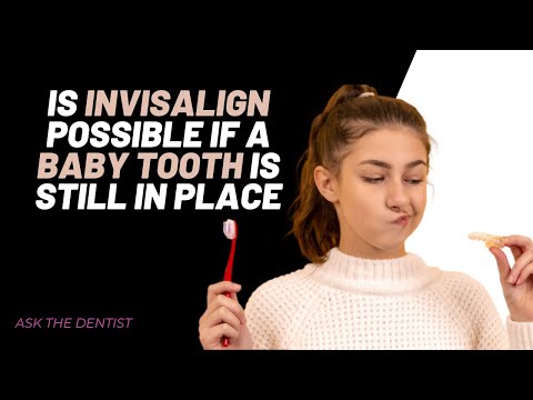 Ask the dentist: Can Invisalign be done if you still have the #babyTooth