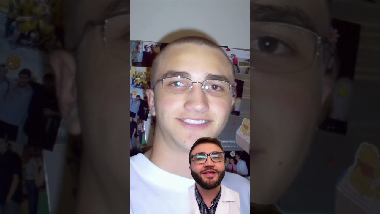 Meu conselho para os jovens que estão ficando calvos