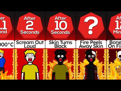 Timeline: What If You Were Burned Alive