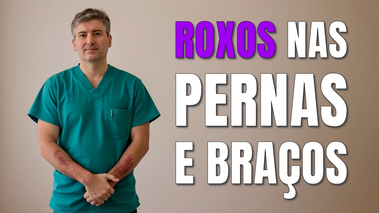 O Médico Revela o Que Causa os Roxos na Pele!