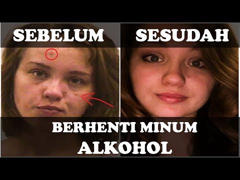 Bagaimana membangkitkan penampilan wanita Sengatan lebah pengobatan impotensi