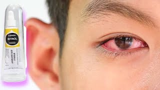 Download lagu Informasi Salep mata Cendo Xytrol untuk mengatasi Infeksi Bakteri Pada mata mp3