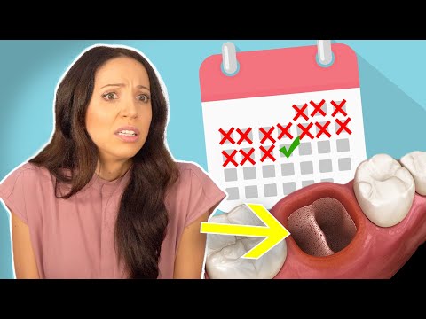When Can You STOP Worrying About Getting A Dry Socket?