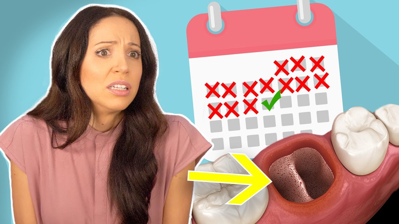 When Can You STOP Worrying About Getting A Dry Socket?