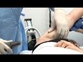 'Lunchtime Lipo': Does Lightning-Fast Procedure Work? 'Lunchtime Lipo': Does Lightning-Fast Procedure Work?