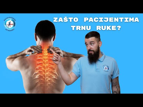 Što je Cervikobrahijalni sindrom i kako nastaje?