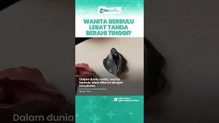 Benarkah Wanita Berbulu Lebat Dianggap Punya Gairah Seksual Tinggi? Begini Faktanya