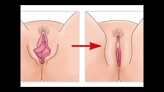 Is my vagina normal Here are the 7 different types of labia