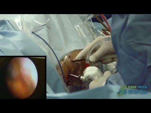 Dolore al collo contusione Pericoloso di un nervo schiacciato nella colonna vertebrale cervicale