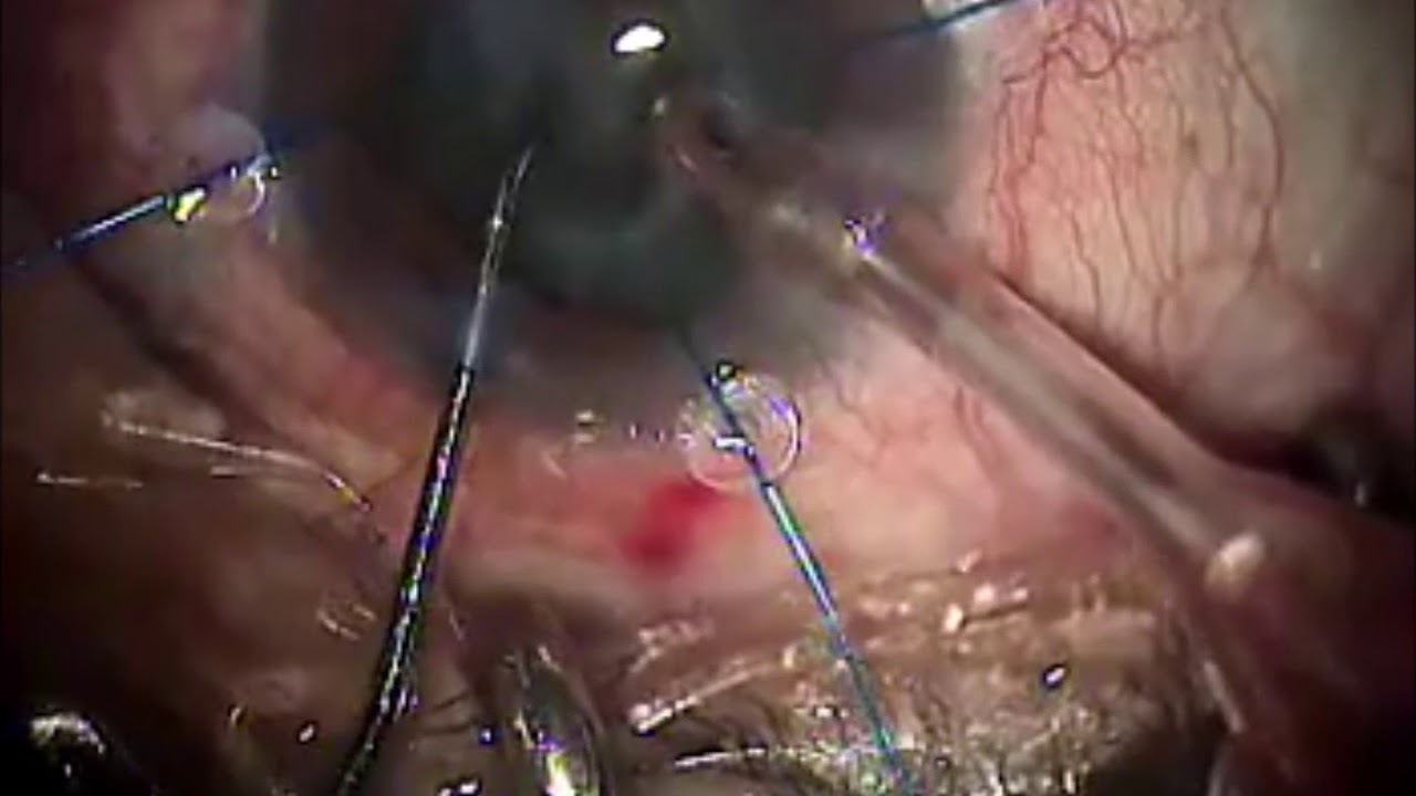 Axel De Jesus Jarillo Figueroa-11