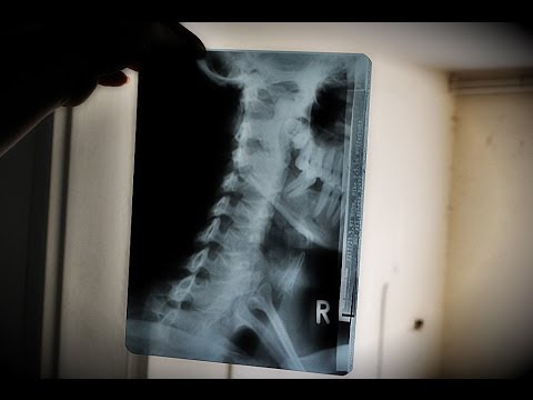 Lost Places XYZ Part 20 - House of Pain