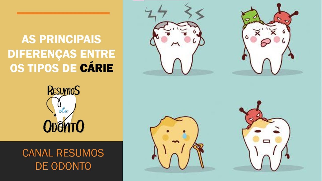 Principais diferenças entre os tipos de cáries | Resumos de Odonto
