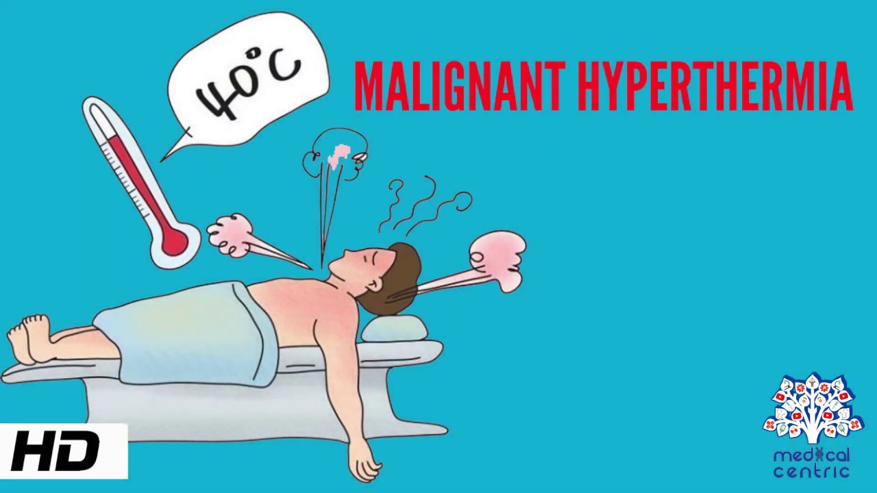 What is the symptoms of hyperthermia?