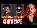 Pourquoi Vinicius a VRAIMENT changé son visage