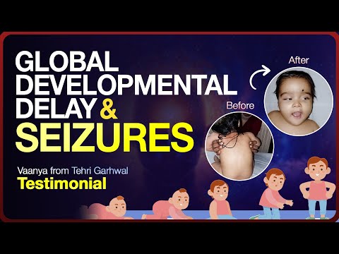 Hope Beyond Seizures | Vaanya’s Recovery Journey with Oriental Medicine & Acupuncture