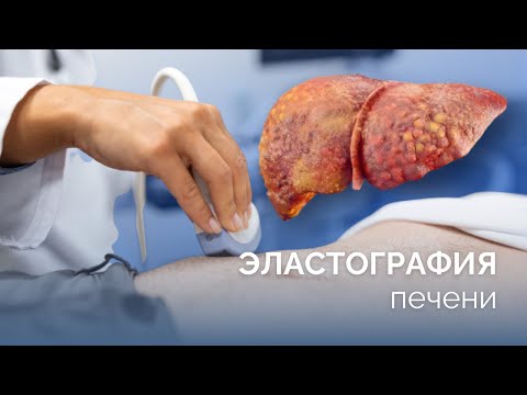Эластография: Диагностика печени