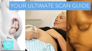 Ultimate Pregnancy Scan Guide | 4D, 3D & 2D Scans | Channel Mum