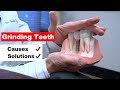 Grinding Teeth (Bruxism) - A Major Cause of Gum Recession
