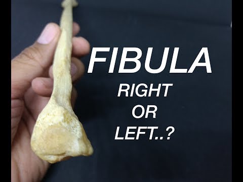 FIBULA - SIDE DETERMINATION