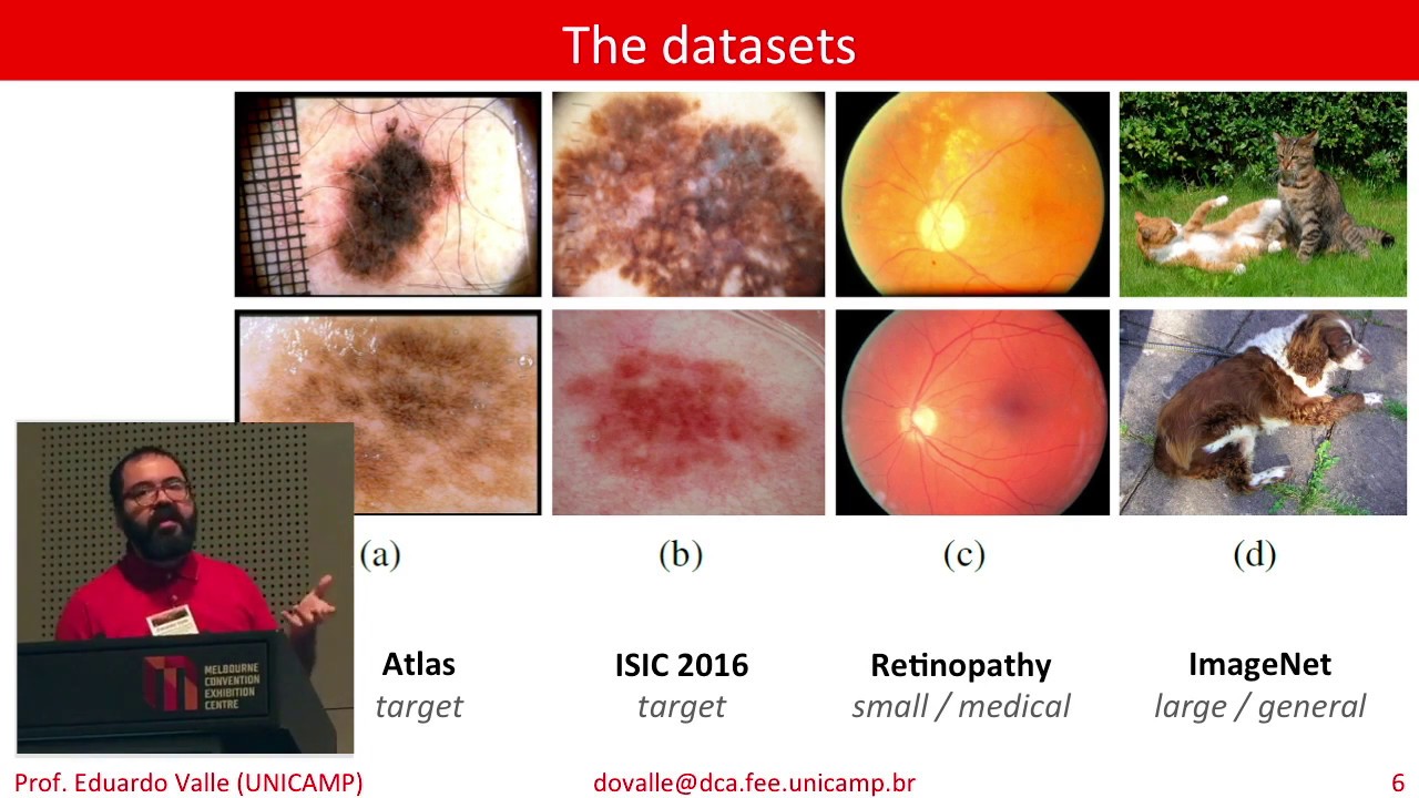 Knowledge Transfer for Melanoma Screening with Deep Learning