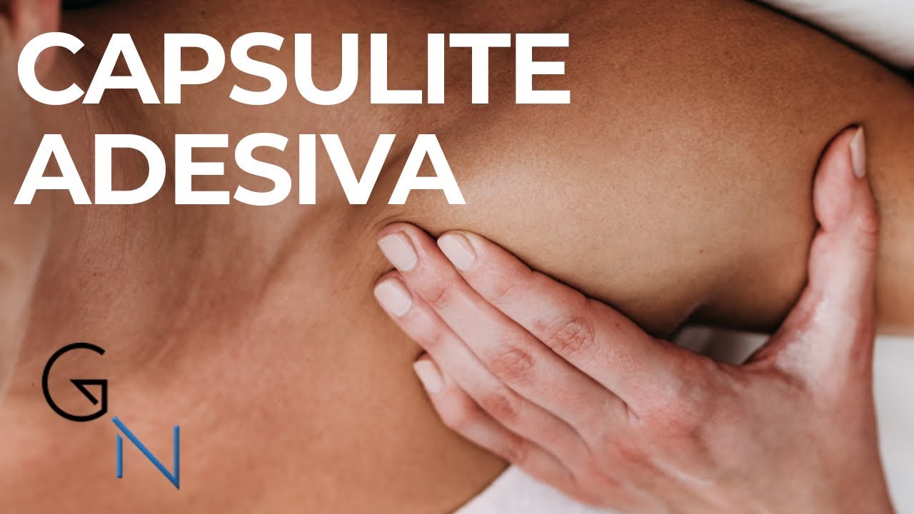 OMBRO CONGELADO OU CAPSULITE ADESIVA: Principais Causas e Tratamentos