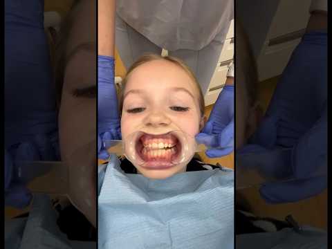 Еду снимать брекеты #betsy