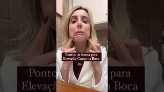 Download lagu Pontos de botox para elevação do canto da boca 🚀🚀 mp3