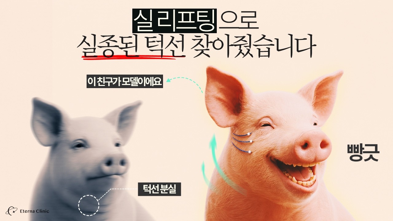 돼지 군에게 실 리프팅 해줬습니다!! #실리프팅 #리프팅효과 #시술