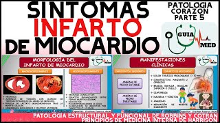 QUÉ ES UN INFARTO AGUDO AL MIOCARDIO SIGNOS Y SÍNTOMAS | GuiaMed