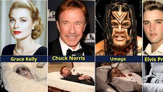 🔥50 Shocking Open-Casket Photos of Celebrities Ever Revealed – You Won’t Believe These Moments