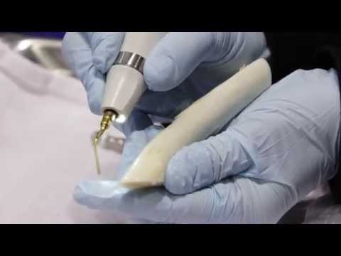 How Piezosurgery® is Changing Bone Surgery in Dentistry