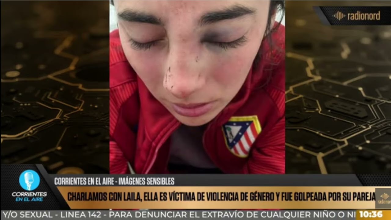   Joven correntina sufrió una brutal golpiza y denuncia graves negligencias de la policía
