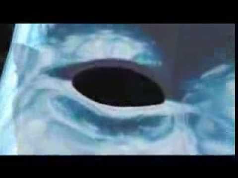 LOSTBOY! AKA Jim Kerr..Sense of Discovery