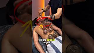 Download lagu Ini dia cara teknik bekam propesional dan handal mp3 Download lagu Ini dia cara teknik bekam propesional dan handal mp3