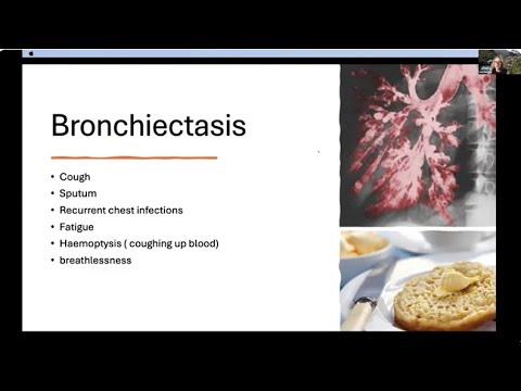 ELF Bronchiectasis Patient Conference 2024