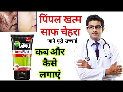 Garnier Acno fight Face Wash HONEST review In Hindi | Results, benefits, Uses, price, info