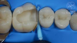 DentalПлюшки 11- адаптация матрицы