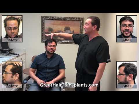 Dr. Brett Bolton Patient Dhruv MaxHarvest&trade; Plus procedure





