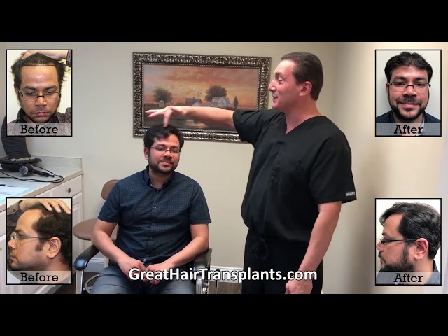 Dr. Brett Bolton Patient Dhruv MaxHarvest&trade; Plus procedure




