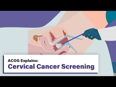 ACOG Explains: Cervical Cancer Screening