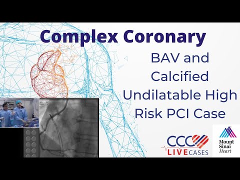 BAV and Calcified Undilatable High Risk PCI Case - February 18, 2018