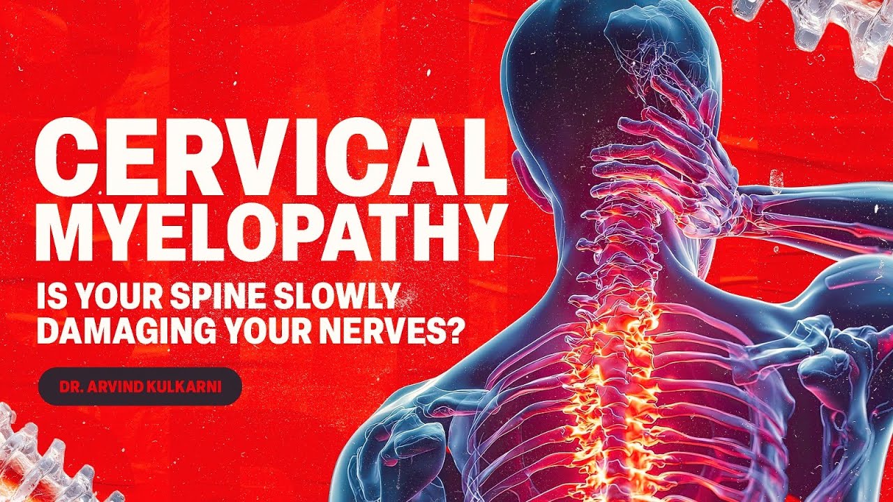 Is Your Neck Pain Actually Cervical Myelopathy? | Warning Signs & Treatment