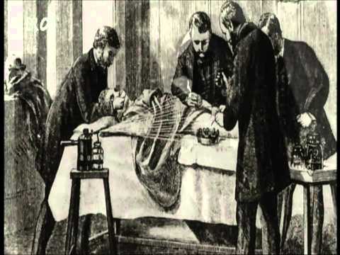 Tetanus und Tuberkulose (1 von 2)