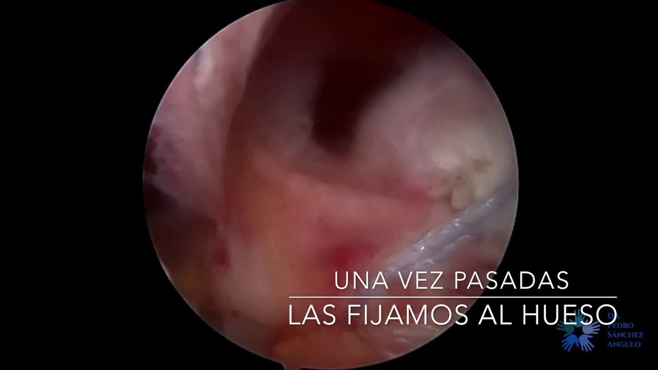 Pedro Sánchez Angulo-18