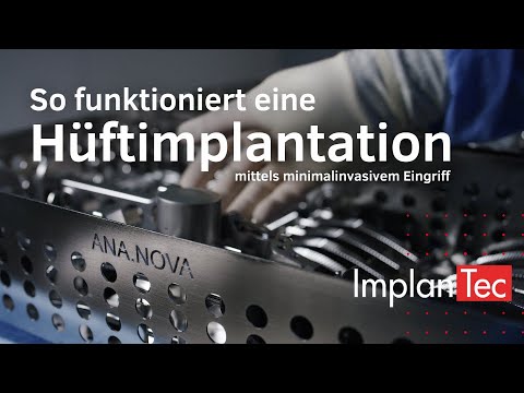 So funktioniert eine Hüftimplantation (Hüft-OP) mittels minimalinvasivem Eingriff
