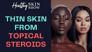 THIN SKIN From Topical Steroid Creams | Dr. Hadar Lev-Tov